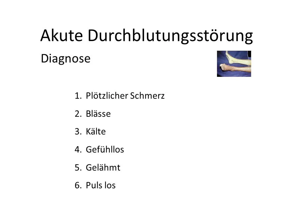 Abbildung zum Artikel: Die besten Tipps bei Durchblutungsstörungen