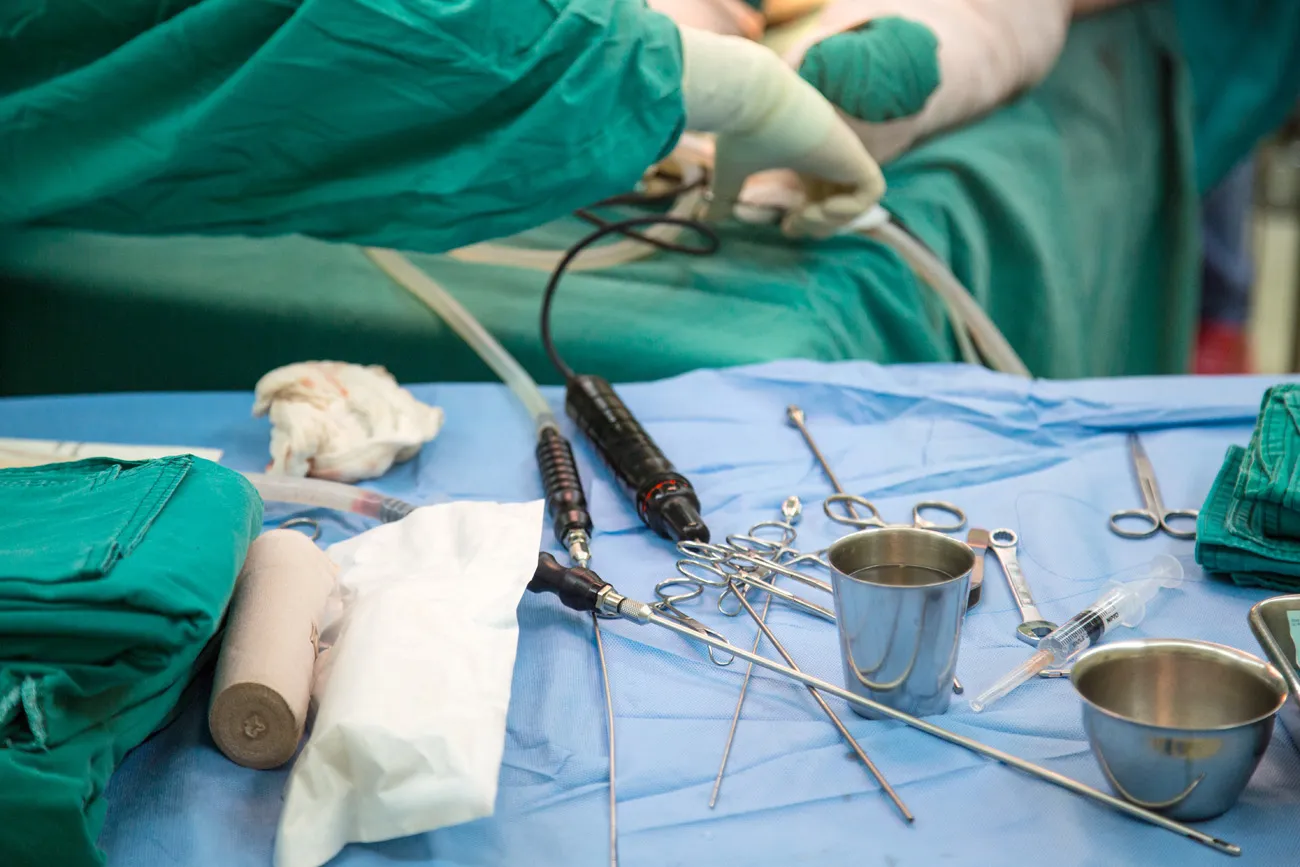 Beitragsbild zum Artikel: Eine neue Methode der Fettabsaugung verwendet Ultraschall
