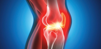 Knieprobleme? Dann probier’s mit Hühnerbrühe oder diesem Supplement!