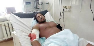 Mehr als tragisch: Bodybuilder stirbt nach Trizepsriss