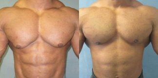 Novaldex (Tamoxifen Citrat) – Fluch oder Segen für BODYBUILDER?