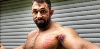 BRUSTMUSKEL GERISSEN: ist DAS das Bodybuilding AUS für Kevin Wolter?