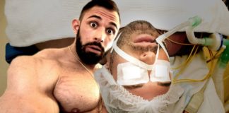 so EMOTIONAL wie noch NIE: Kevin Wolter reagiert auf seine BRUSTMUSKEL OP!