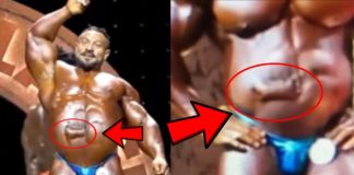SORGE um Roelly Winklaar: was ist mit seinem Bauch passiert?
