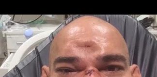 Fast jemand GETÖTET? – Matthias Botthof gesteht!